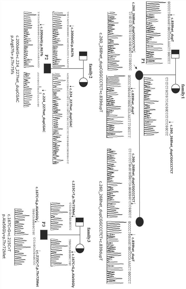 Primer set for detecting human SERPINF1 gene mutation and kit thereof