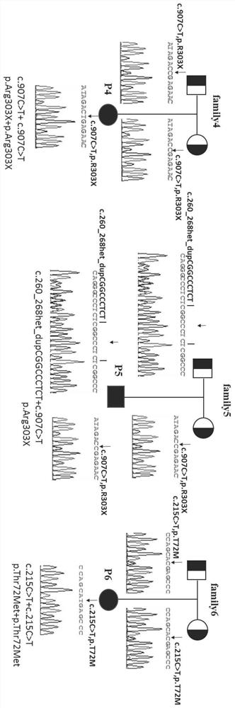 Primer set for detecting human SERPINF1 gene mutation and kit thereof