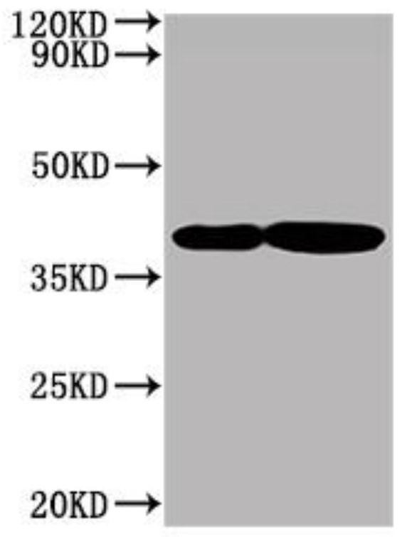 Kit for separating exosome from cell supernatant and use method of kit