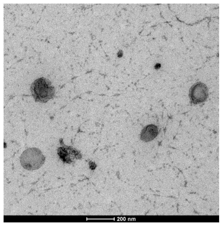 Kit for separating exosome from cell supernatant and use method of kit