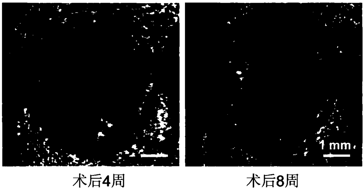 Mineralized bone tissue engineering scaffold and preparation method thereof