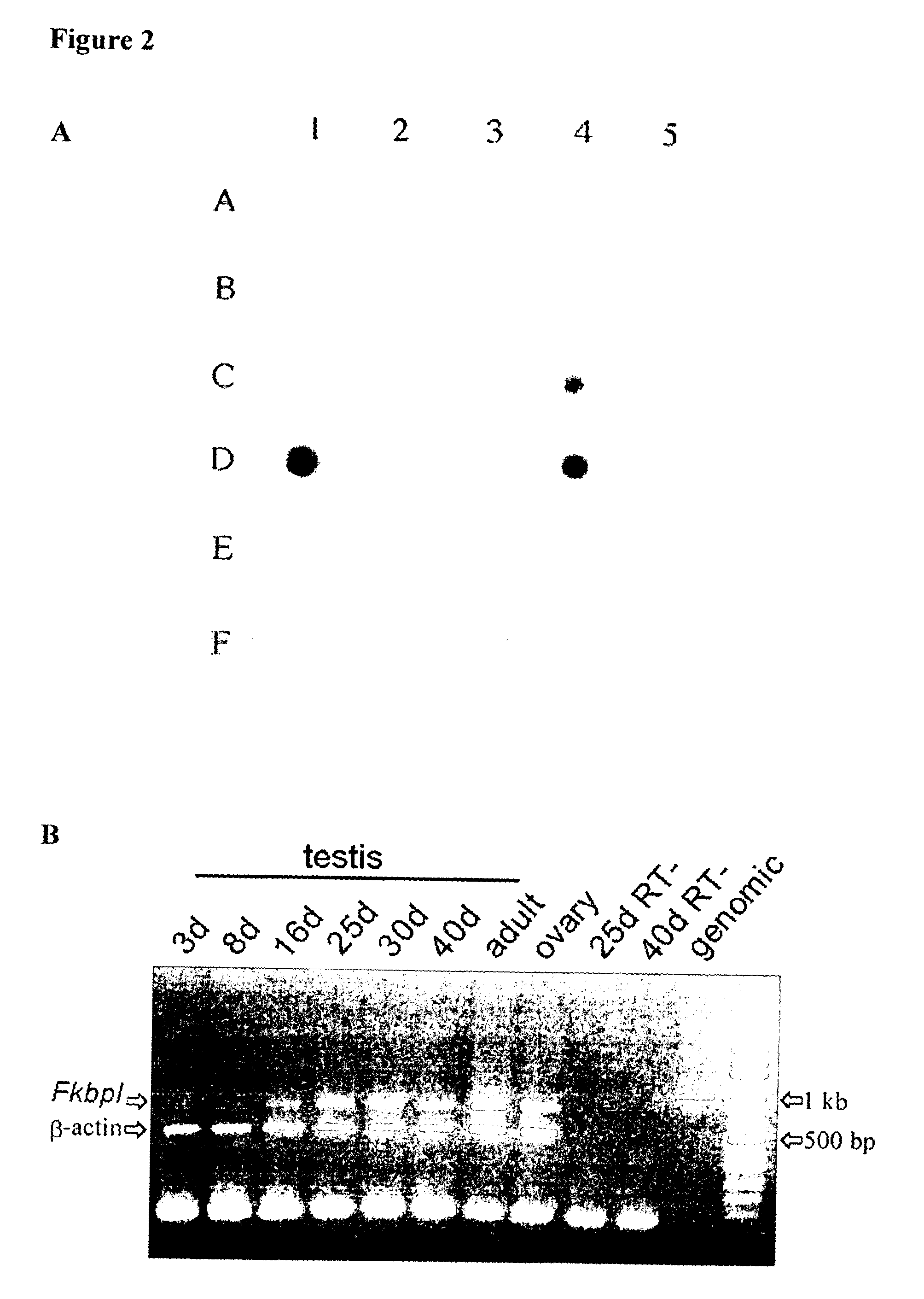 Use of FKBPL gene to identify a cause of infertility