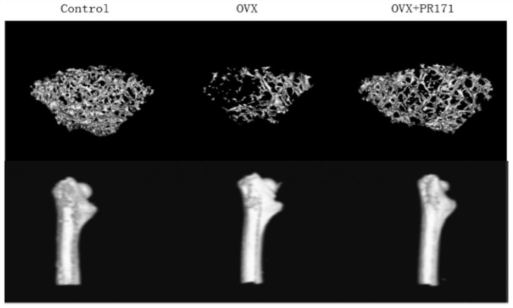 Application of proteasome inhibitor PR171 in preparation of medicine for treating osteoporosis