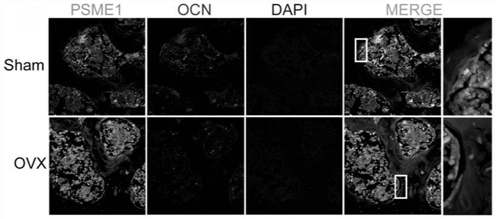 Application of proteasome inhibitor PR171 in preparation of medicine for treating osteoporosis