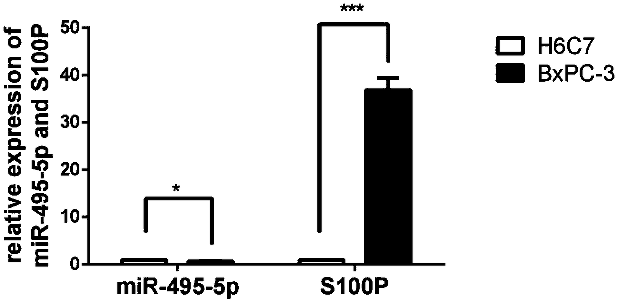 Application of miR-495-5p in preparation of products for diagnosis, prognosis, prevention or treatment of pancreatic cancer