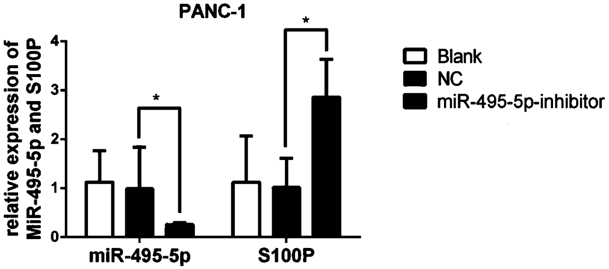 Application of miR-495-5p in preparation of products for diagnosis, prognosis, prevention or treatment of pancreatic cancer