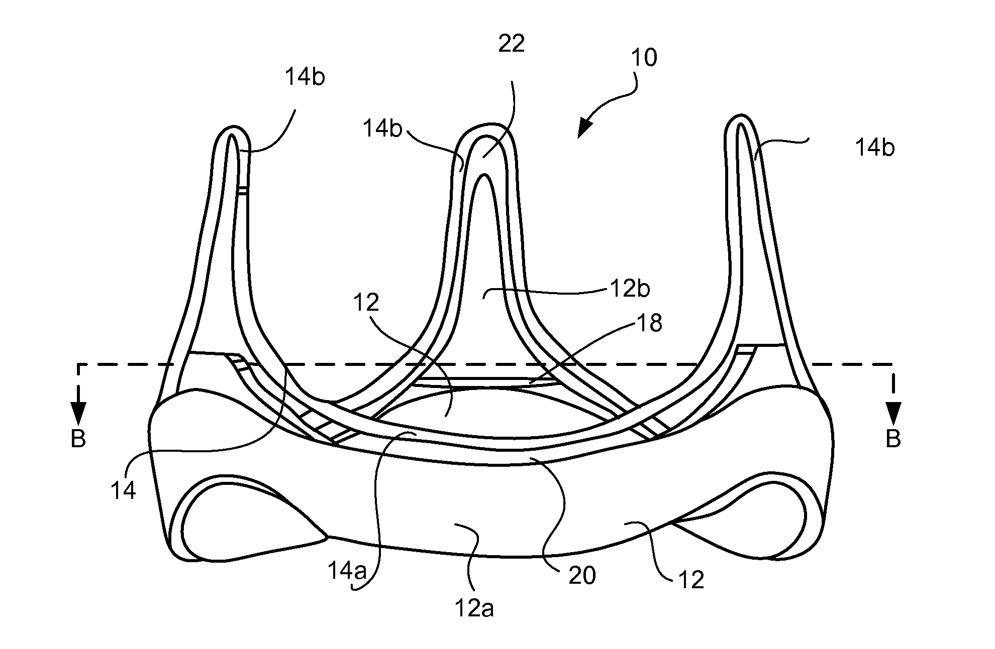 Prosthetic Heart Valve