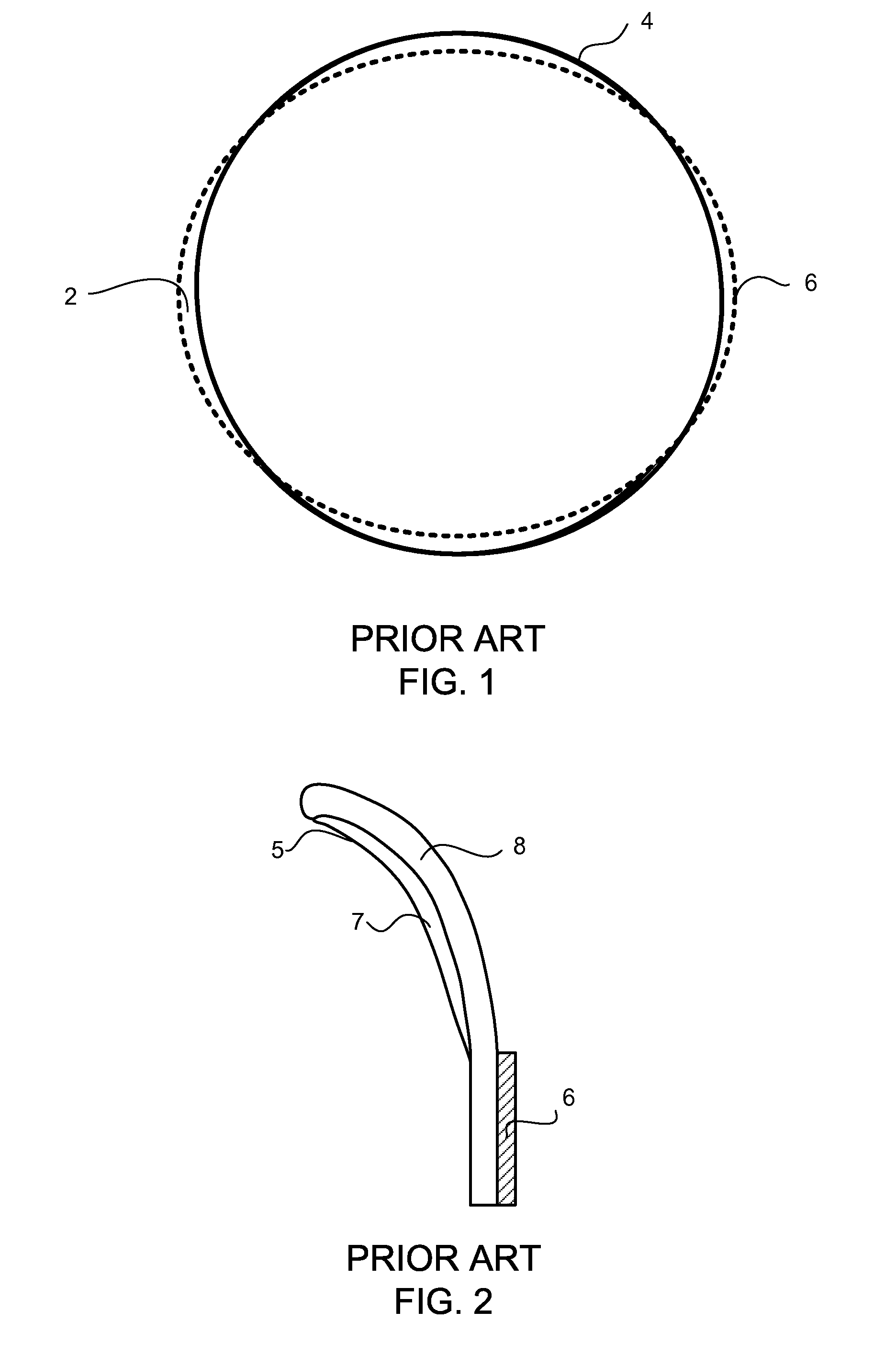 Prosthetic Heart Valve