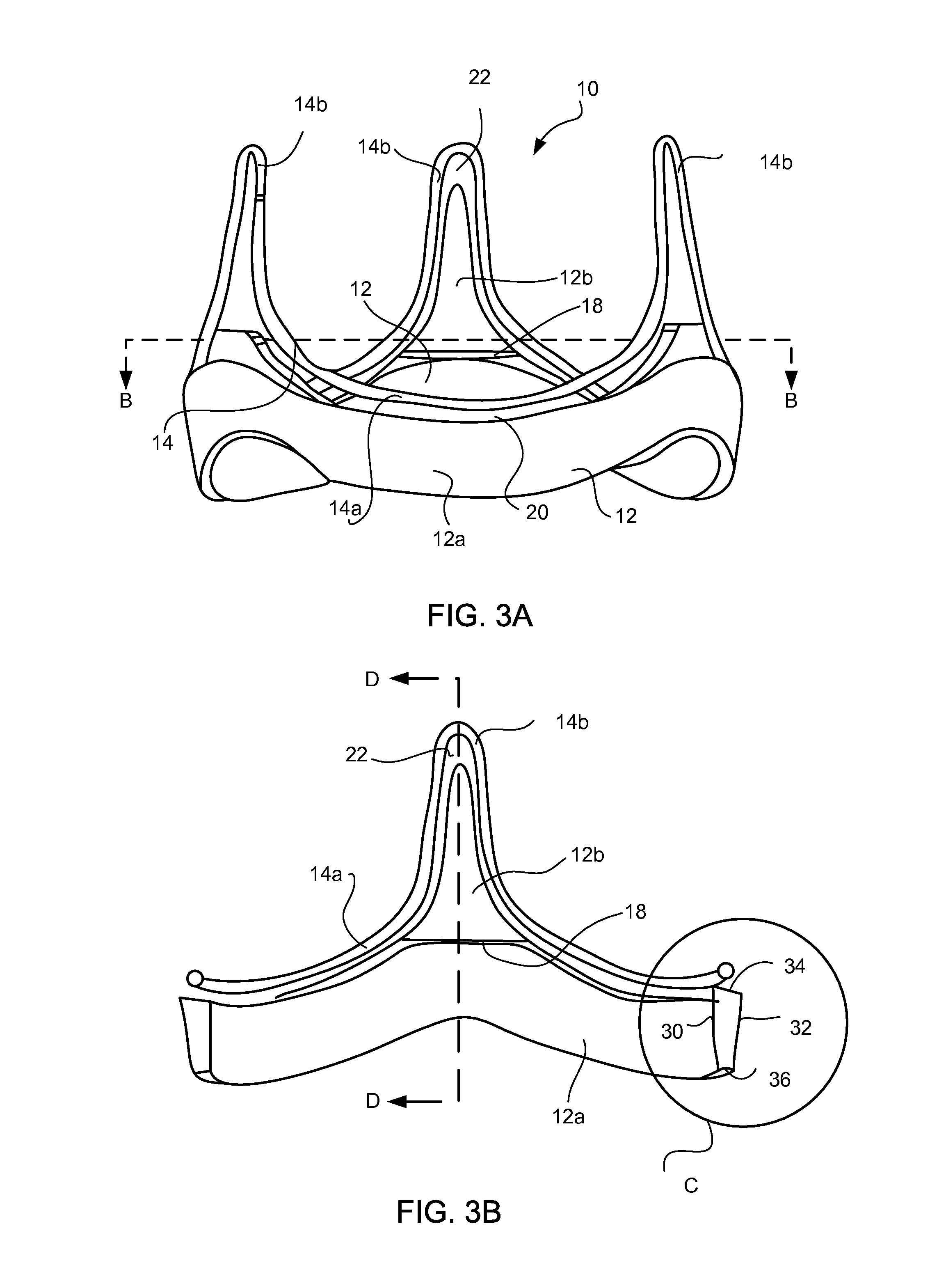 Prosthetic Heart Valve