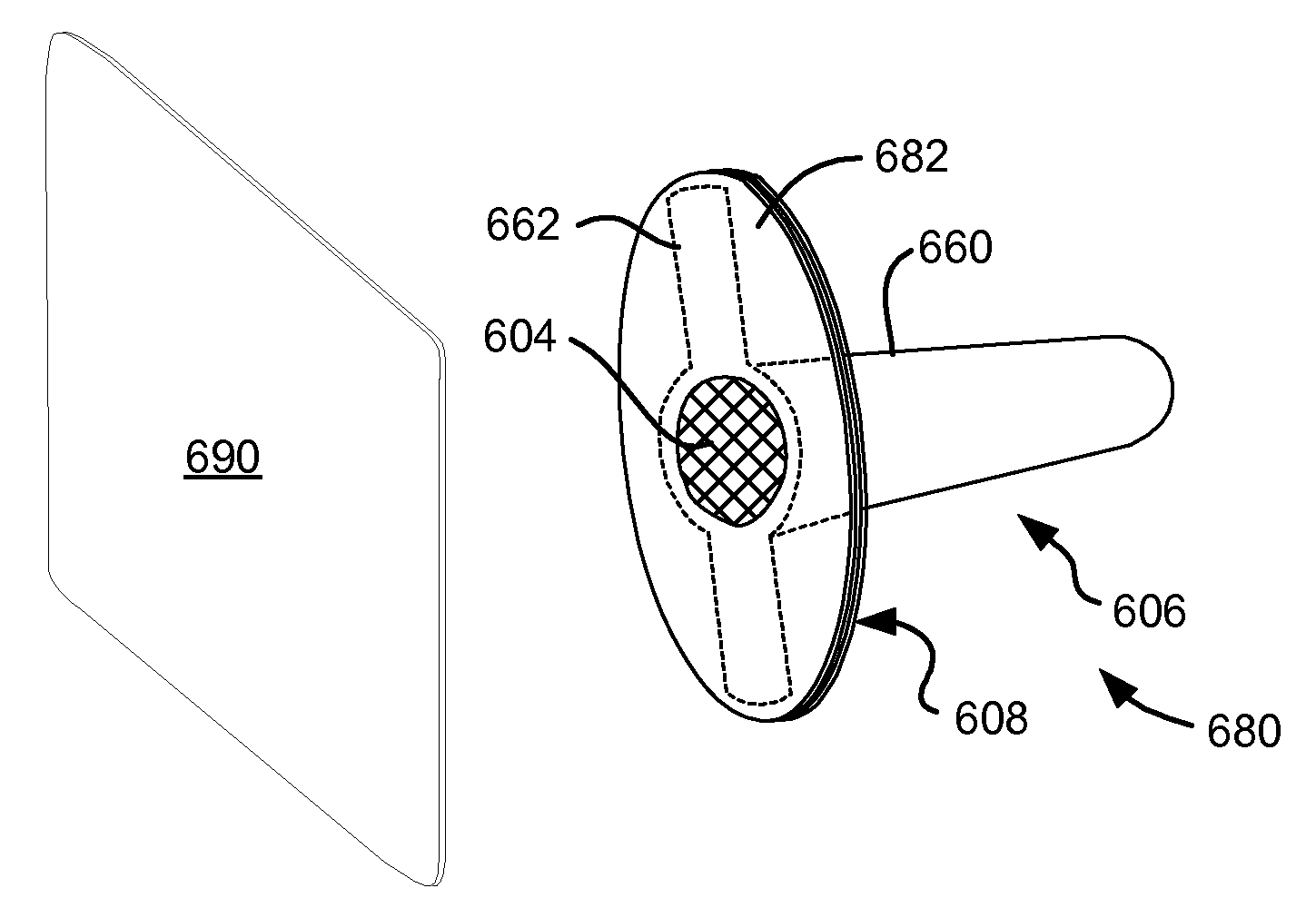 Variable length pneumostoma management system for treatment of chronic obstructive pulmonary disease