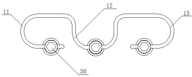 Stretch type three-vertebra double-gap posterior non-fusion fixation system