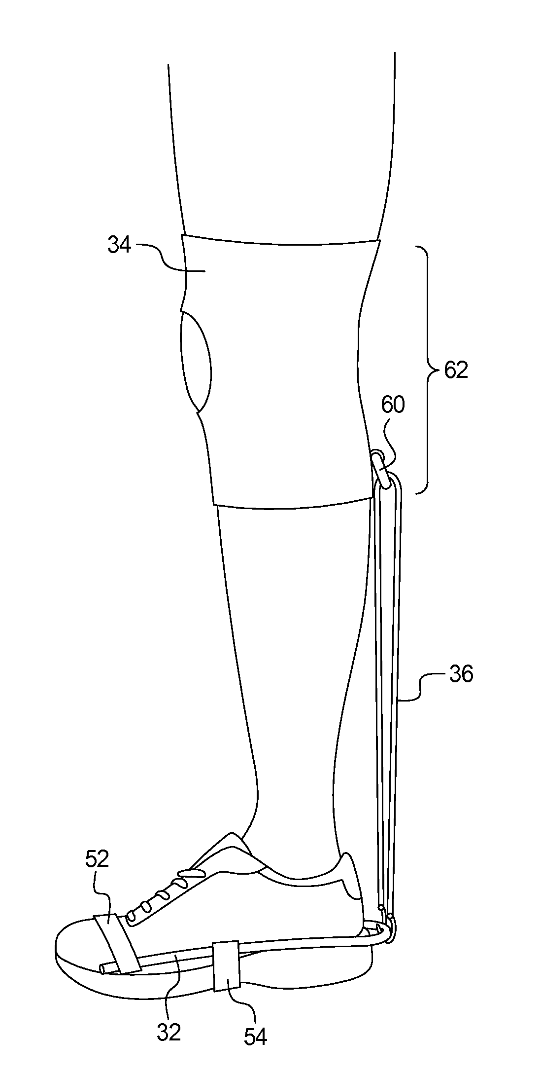 Device for mitigating plantar fasciitis