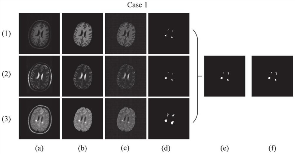 Image segmentation method and system based on fuzzy C-means and probability label fusion