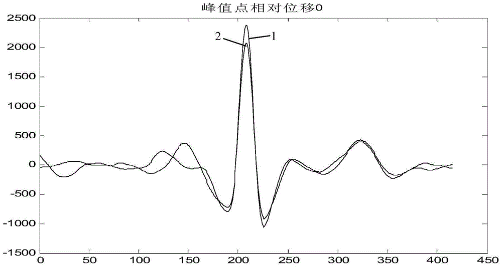 Electrocardio normality/abnormality big-data processing method and device