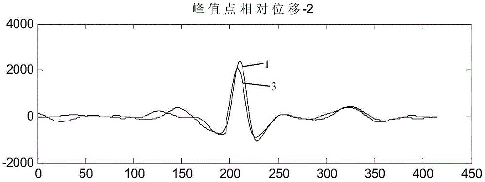 Electrocardio normality/abnormality big-data processing method and device