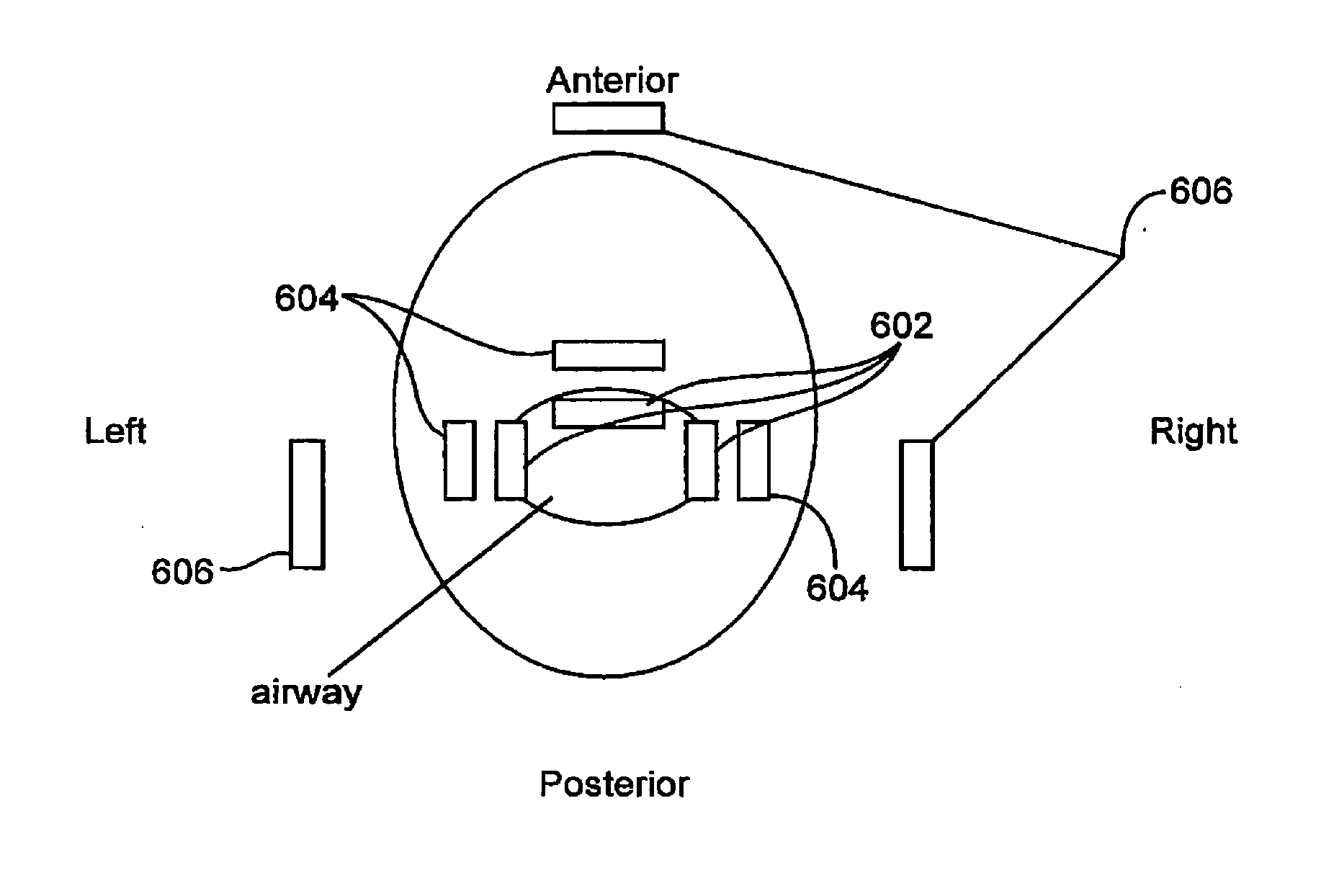 Altering the stiffness, size and/or shape of tissues for breathing disorders and other conditions