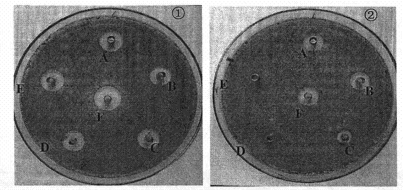 Preparation and use of lilac grey streptomycete and active product thereof