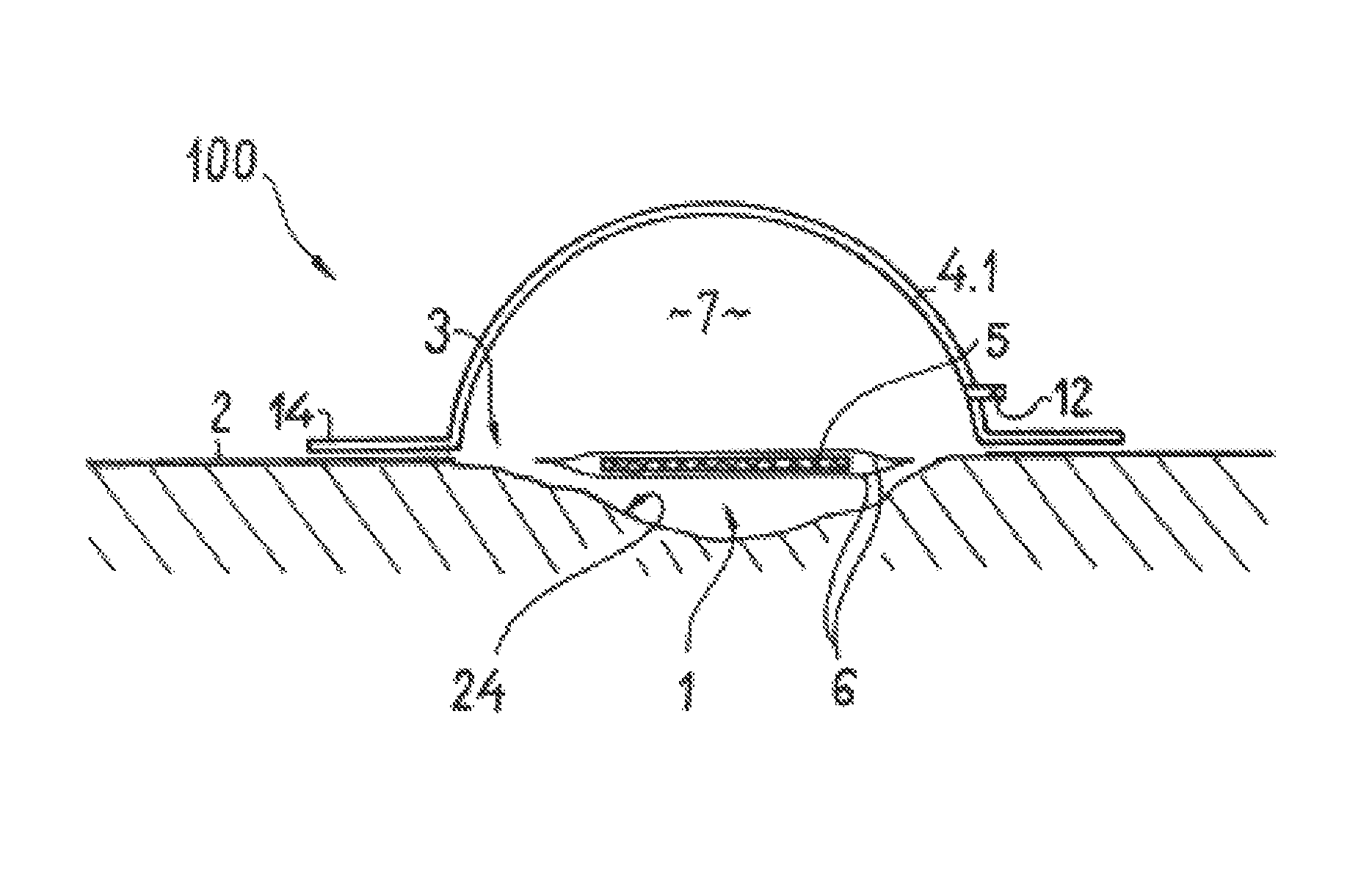 Wound treatment device with elastically deformable vacuum producing element