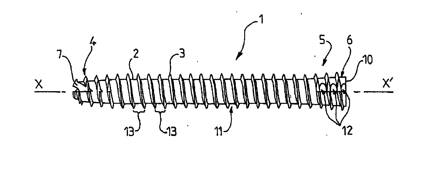 Osteosynthesis screw with reduced radial compression