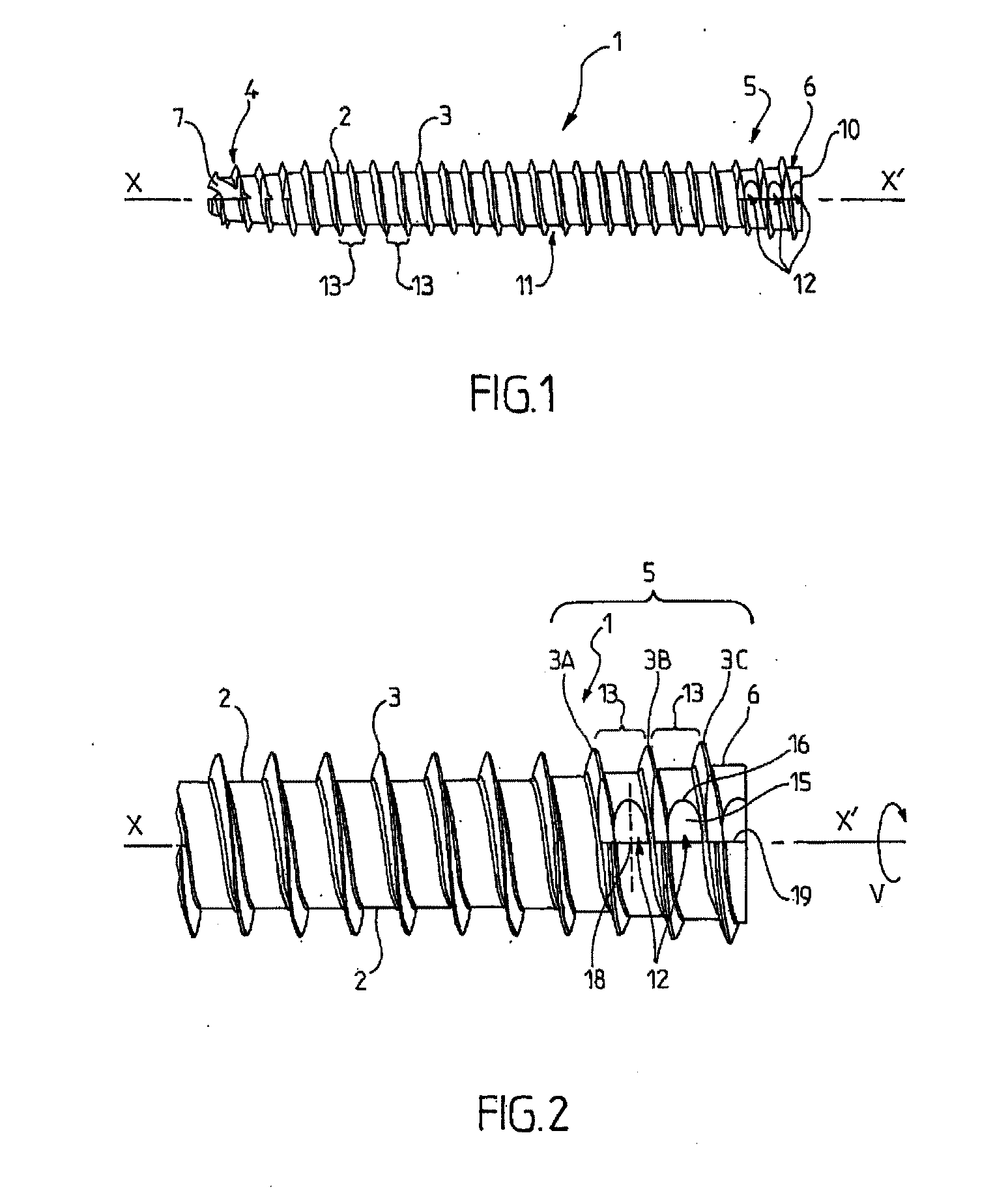 Osteosynthesis screw with reduced radial compression