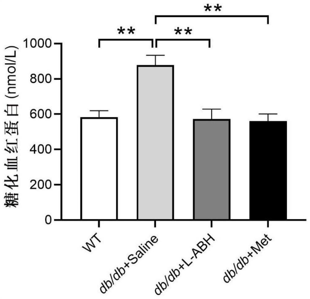 Application of L-aspartic acid-beta-hydroxamate in preparation of medicine for treating type 2 diabetes