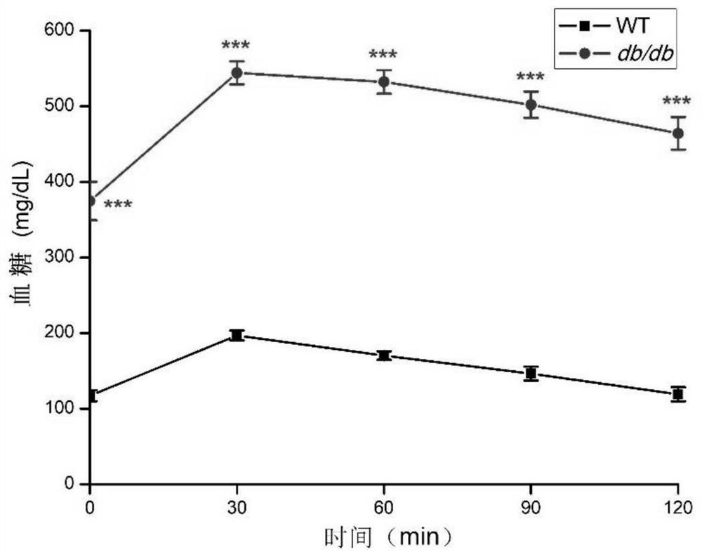 Application of L-aspartic acid-beta-hydroxamate in preparation of medicine for treating type 2 diabetes