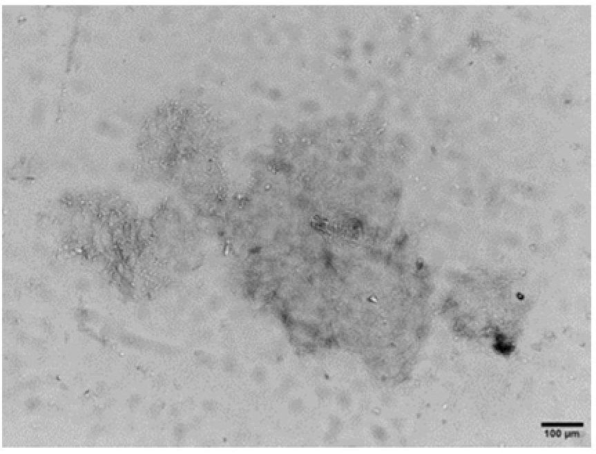 Anti-attenuation fungal fluorescent dyeing liquid and preparation method thereof