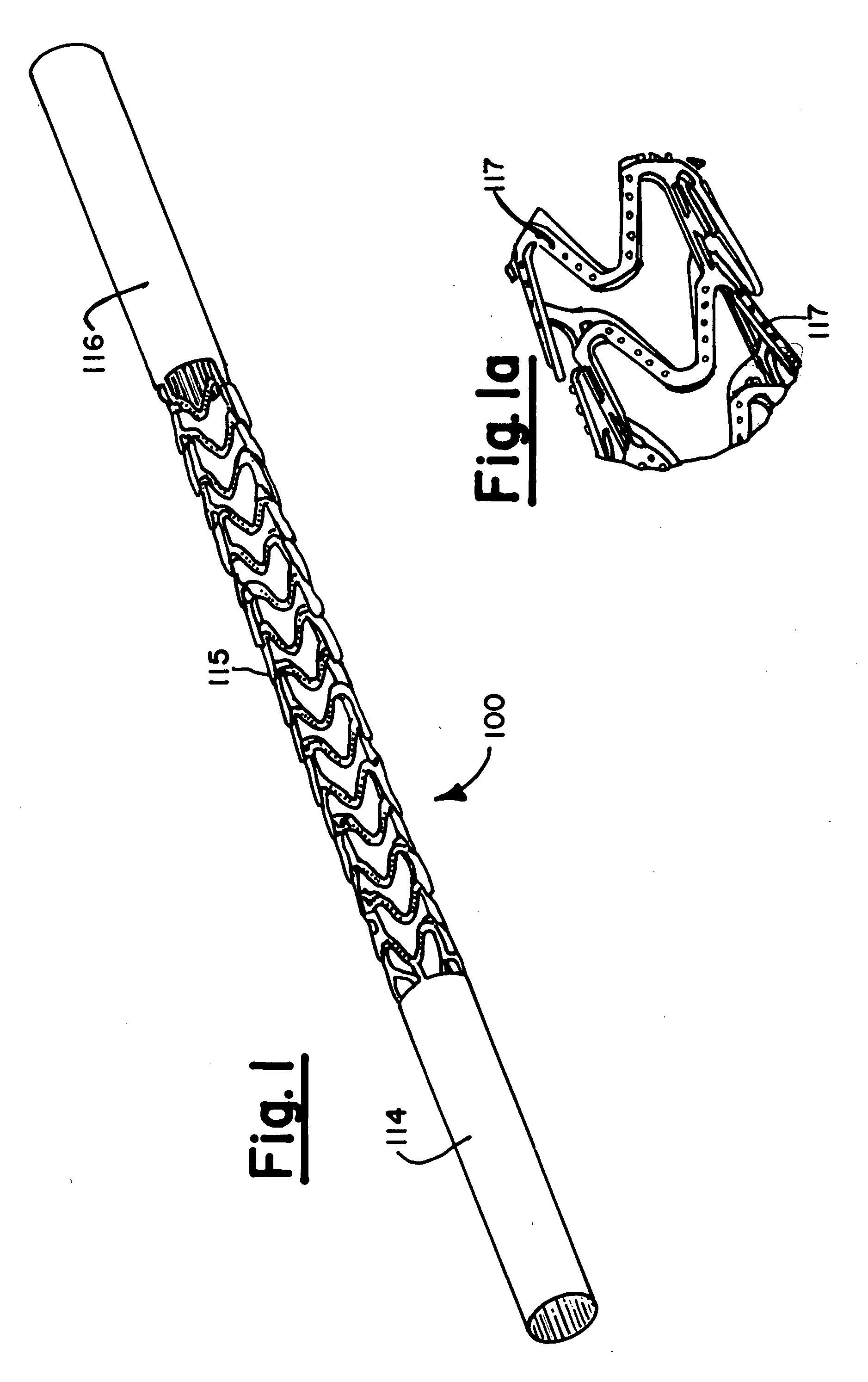 Pitted metallic implants and method of manufacturing thereof