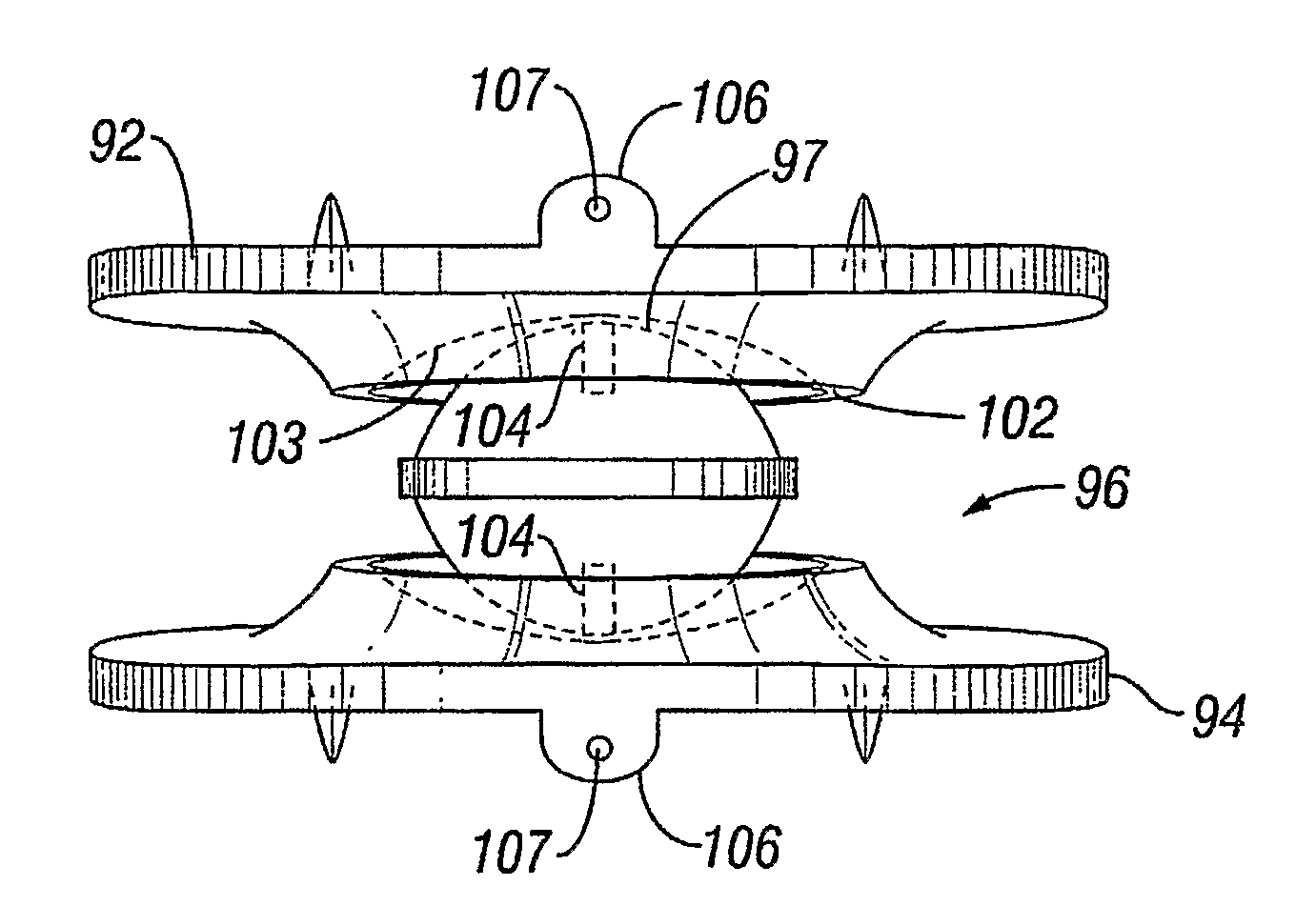 Artificial Spinal Disc