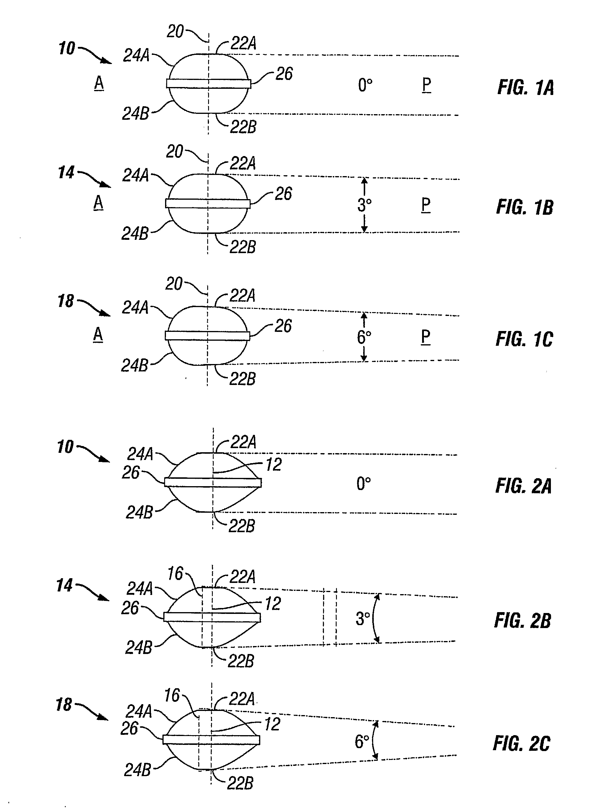 Artificial Spinal Disc