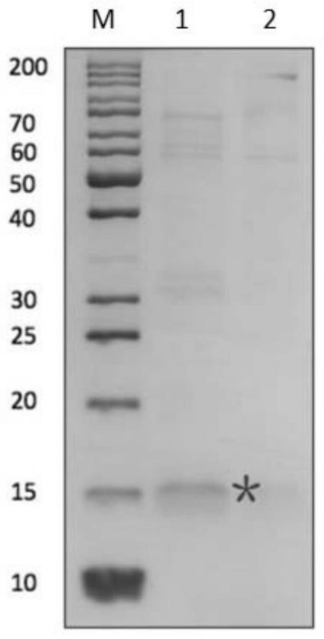 Interleukin-2 derivative as well as preparation method and application thereof