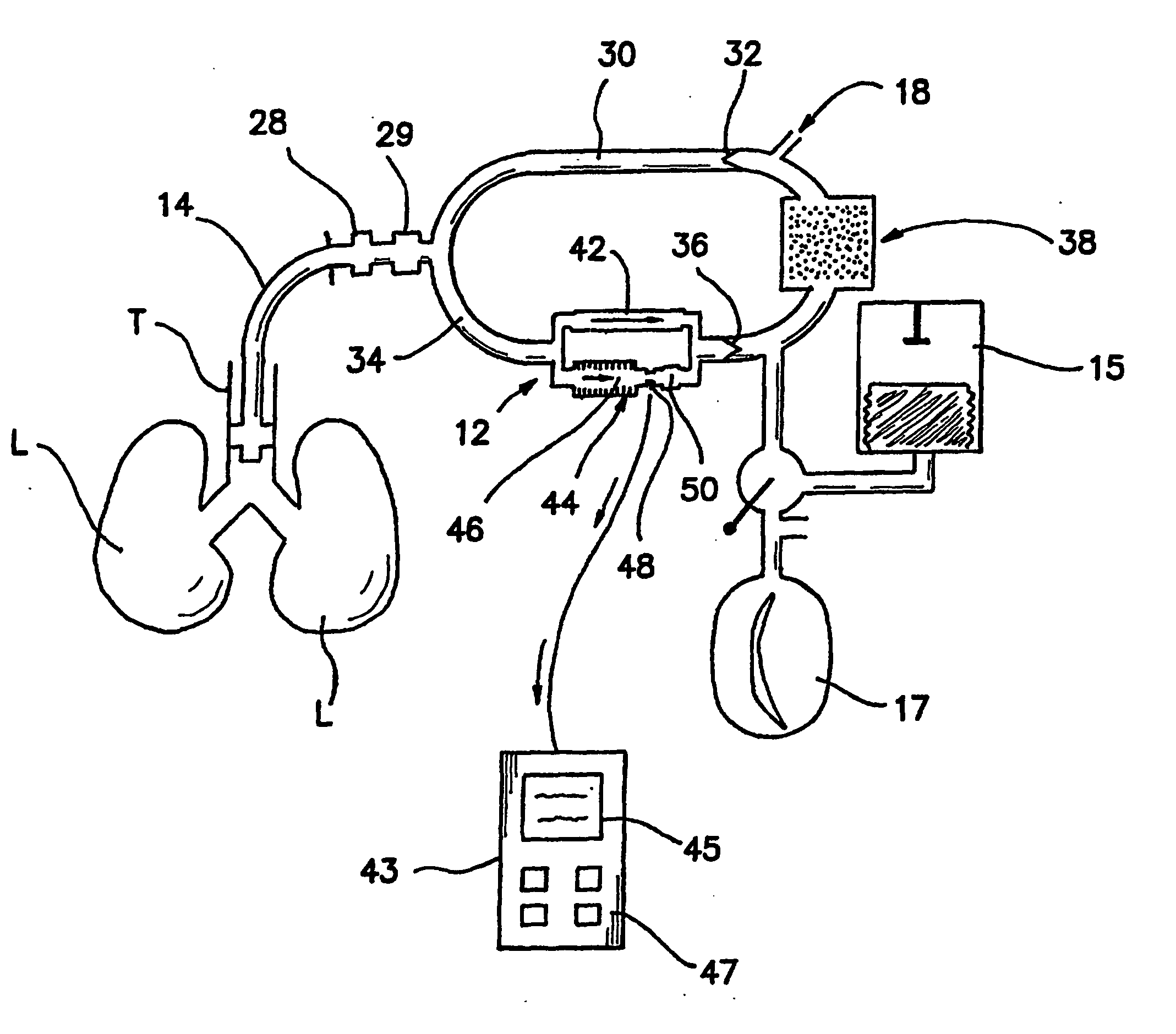 Bymixer apparatus and method for fast-response, adjustable measurement of mixed gas fractions in ventilation circuits