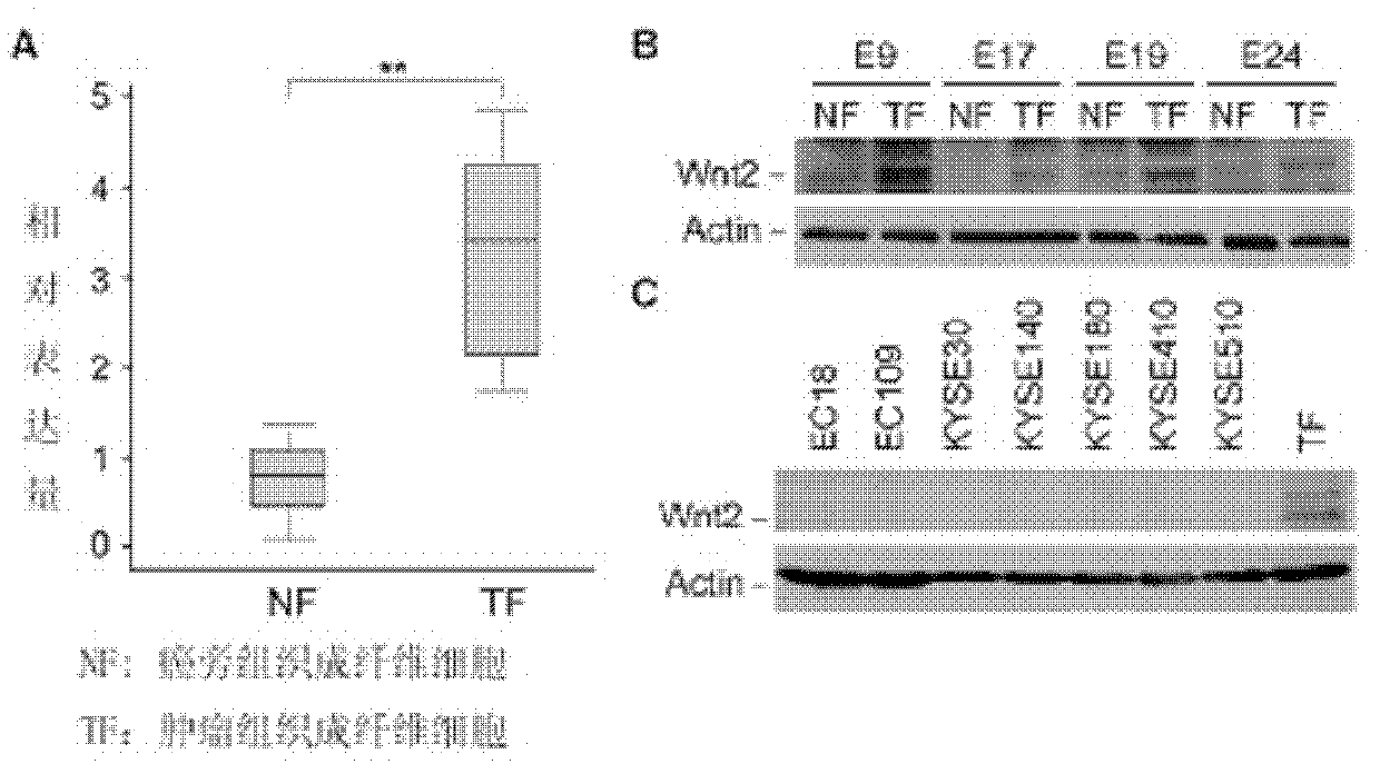 Application of Wnt2 to preparation of medicament for inhibiting esophageal cancer