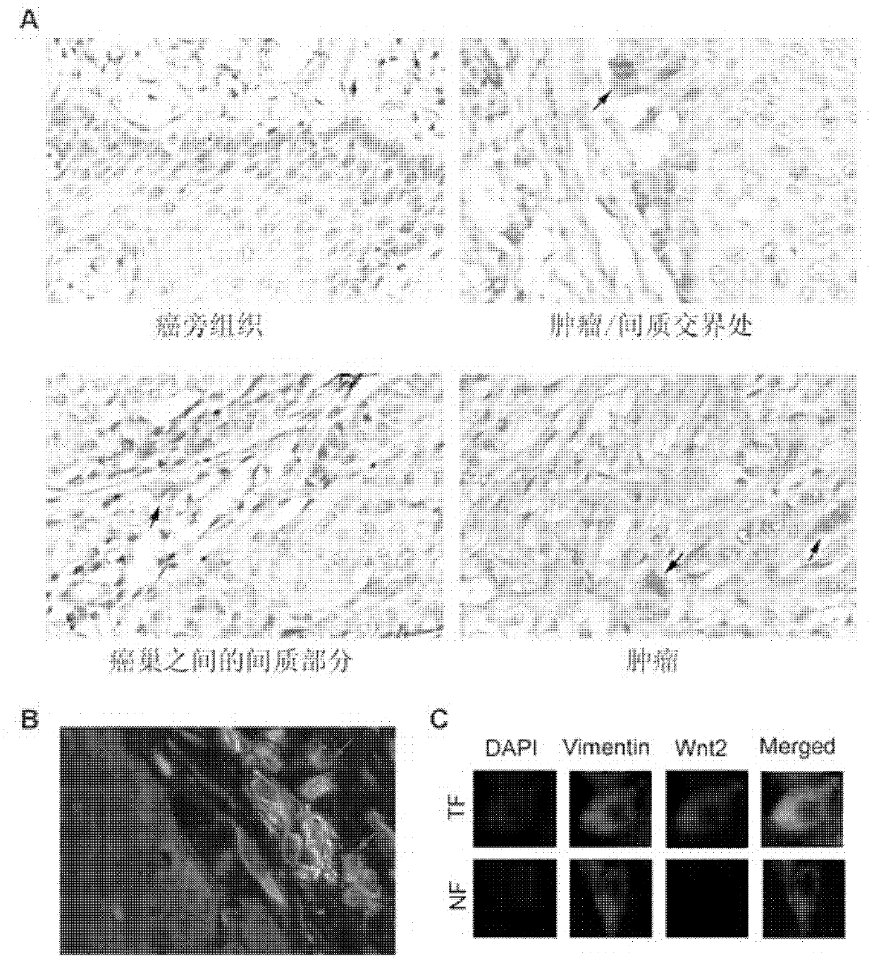 Application of Wnt2 to preparation of medicament for inhibiting esophageal cancer