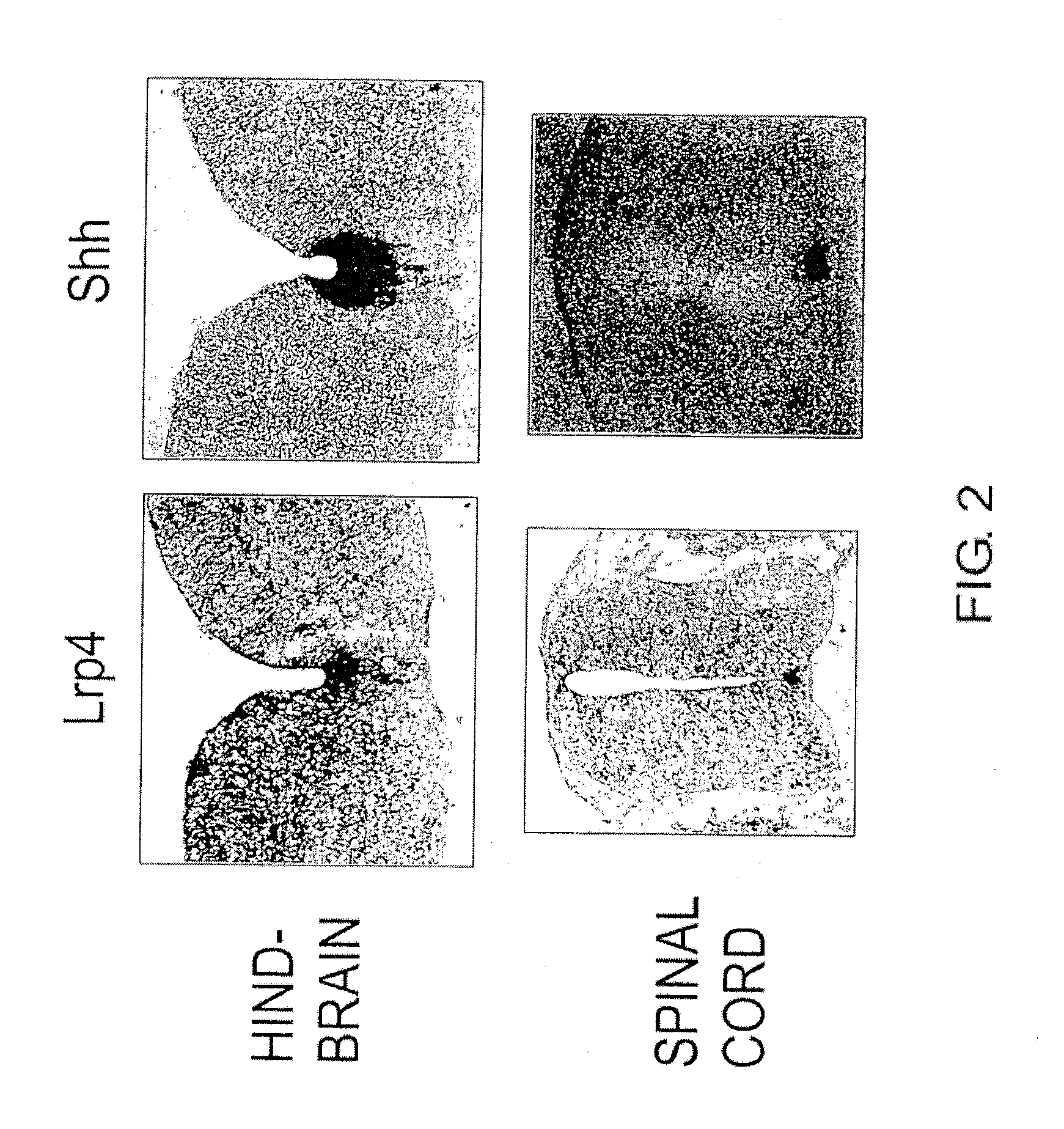 Lrp4/CORIN DOPAMINE-PRODUCING NEURON PRECURSOR CELL MARKER