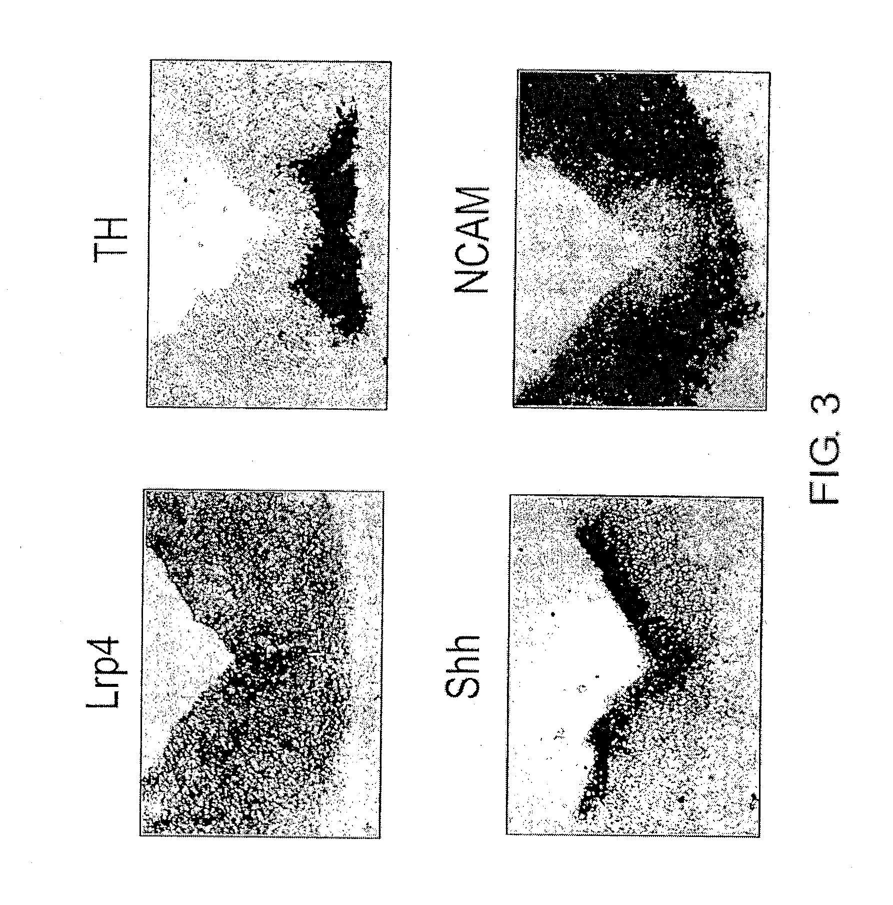 Lrp4/CORIN DOPAMINE-PRODUCING NEURON PRECURSOR CELL MARKER