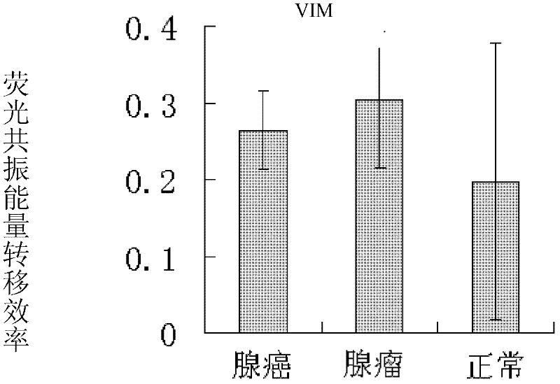 Primer capable of detecting methylation of promoter of gene related to colonic adenocarcinoma