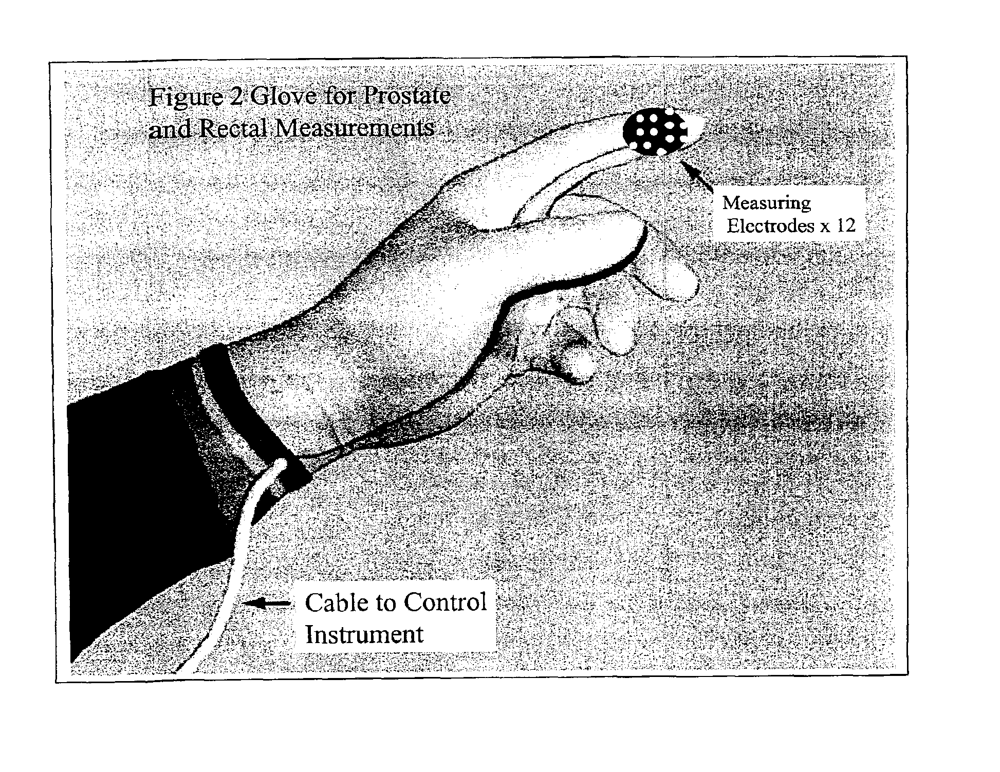 Method and system for detecting electrophysiological changes in pre-cancerous and cancerous tissue