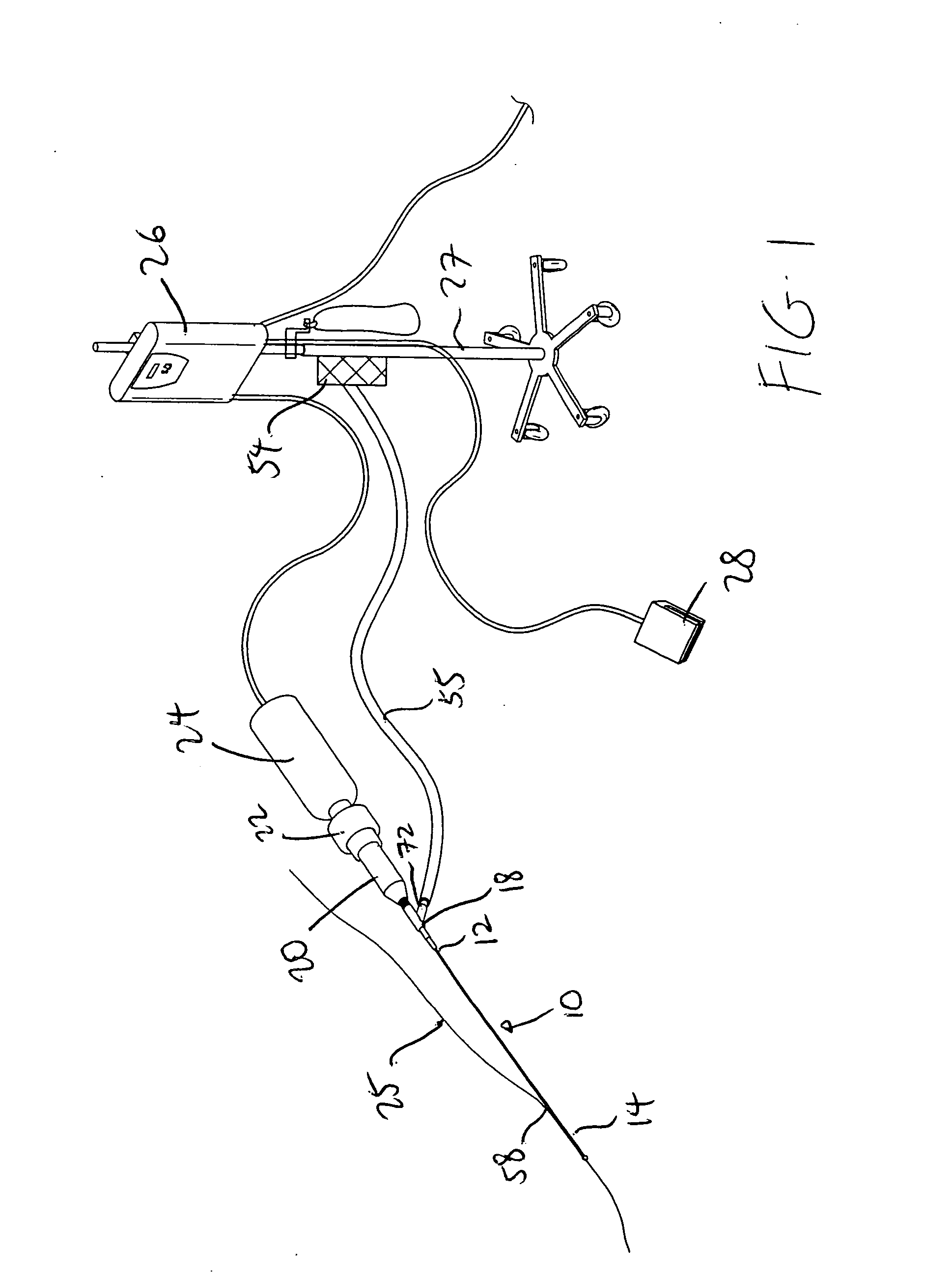 Ultrasound catheter having protective feature against breakage