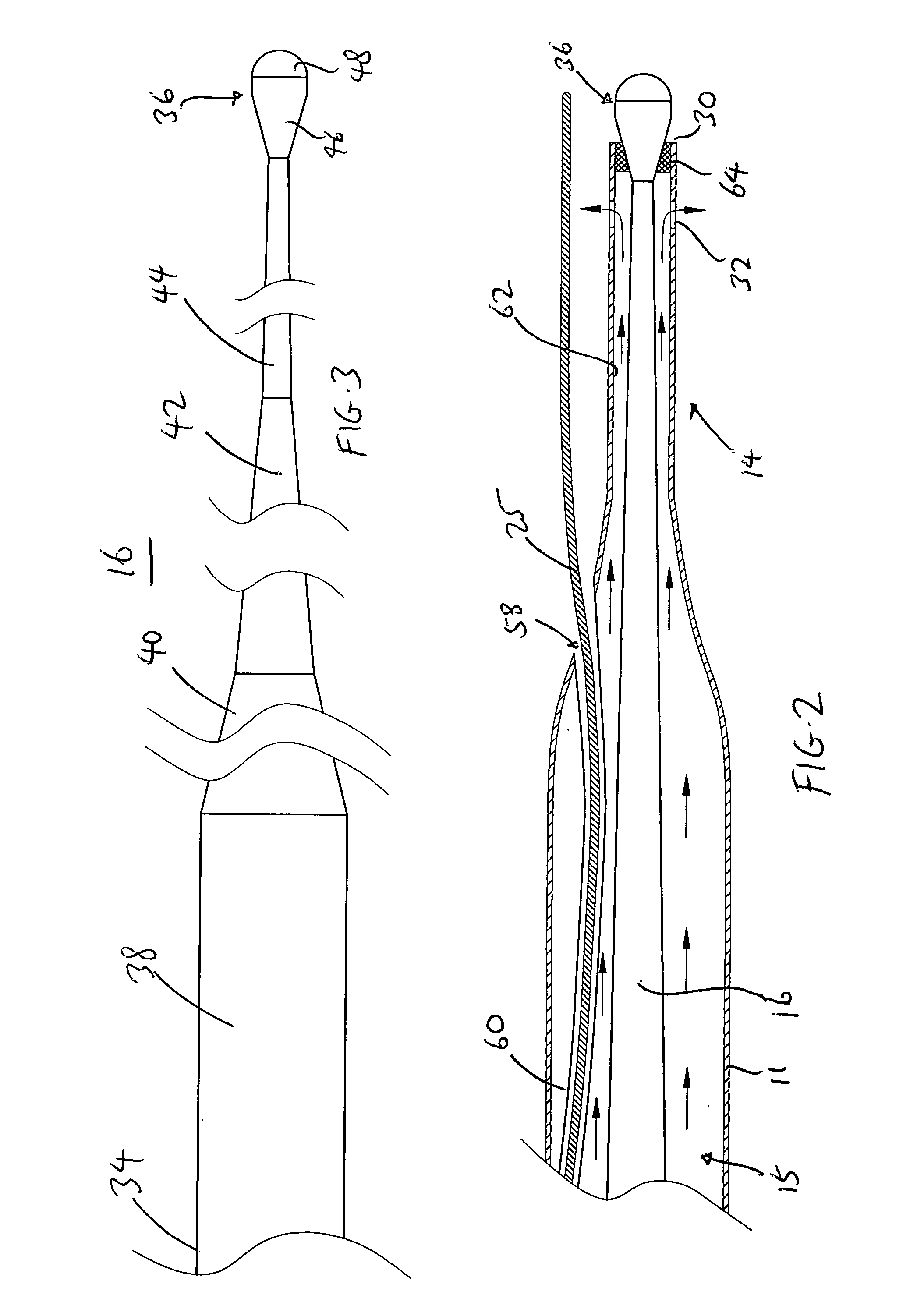 Ultrasound catheter having protective feature against breakage