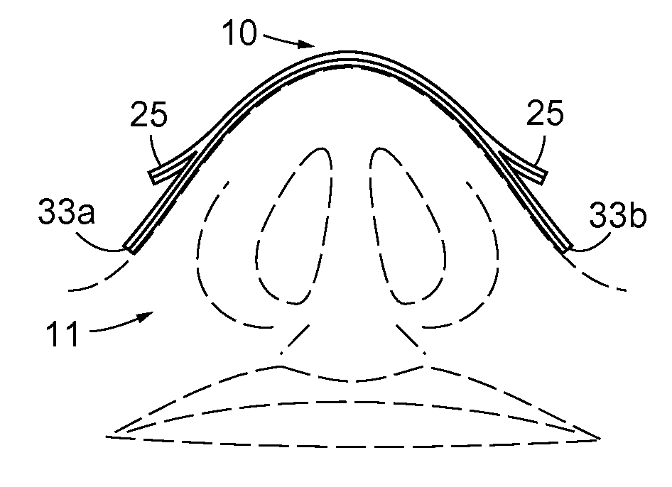 Nasal Dilator With Means To Direct Resilient Properties