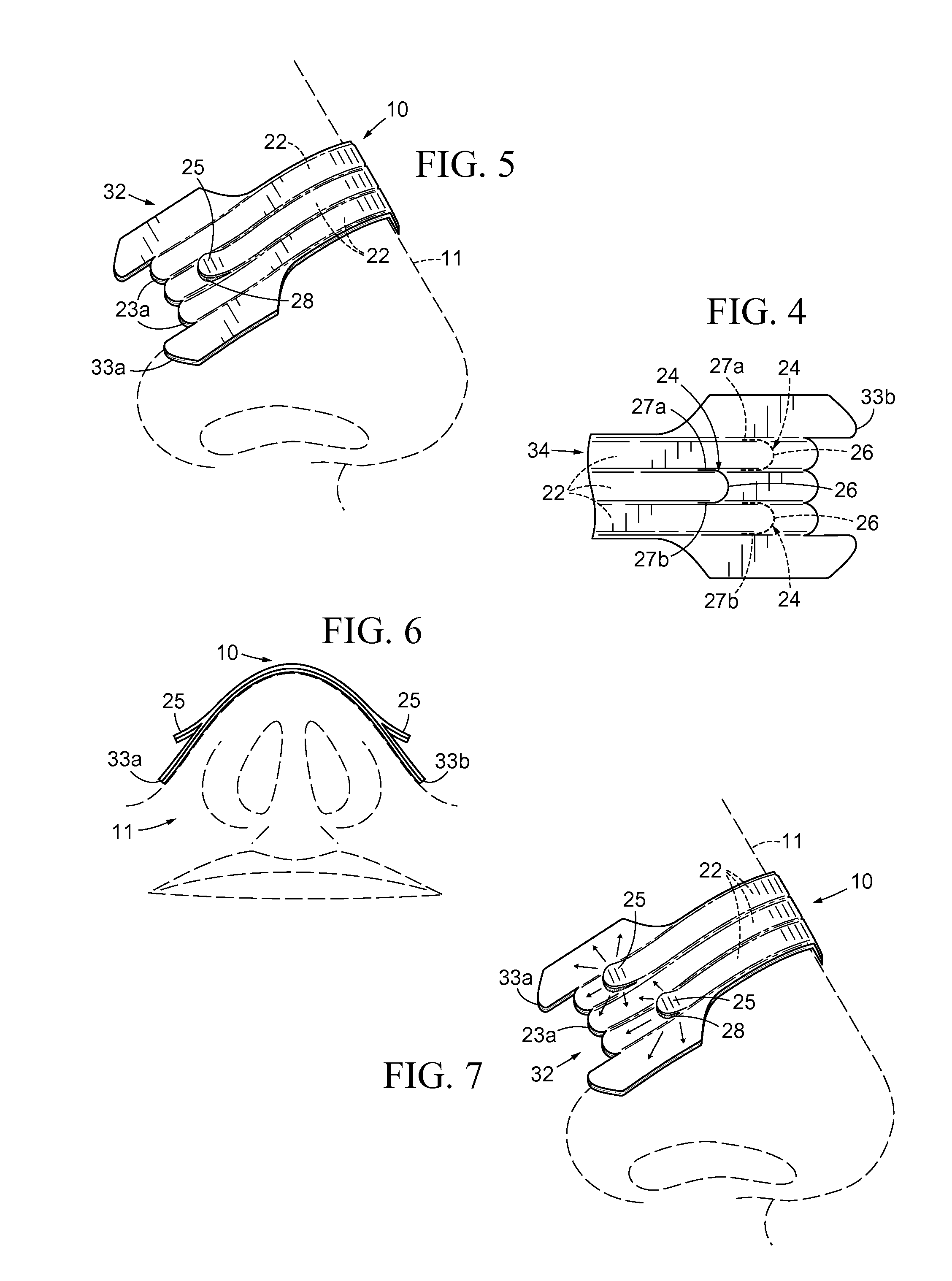 Nasal Dilator With Means To Direct Resilient Properties