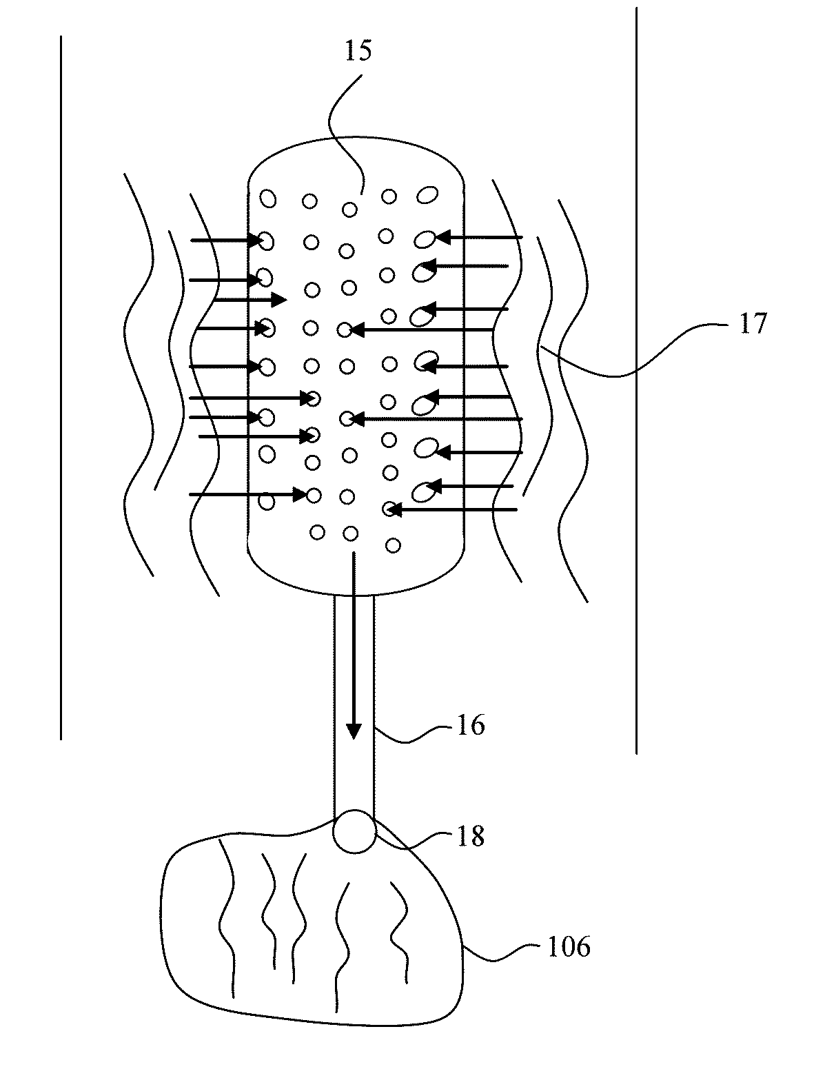 Blood filtering device and method