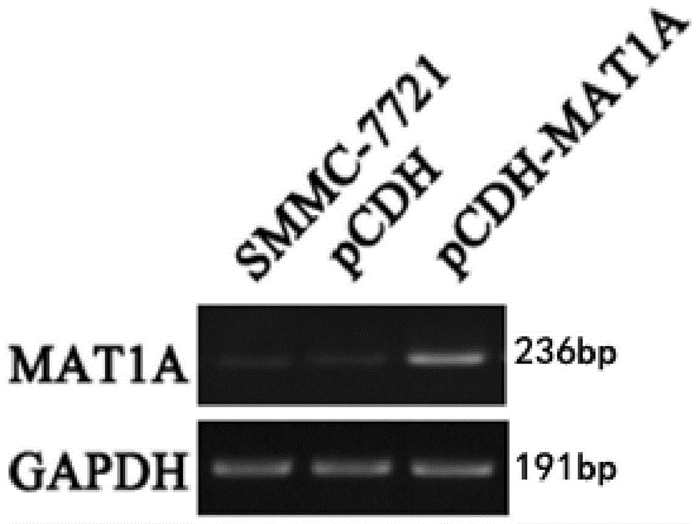 siRNA capable of inhibiting MAT2A genetic expression and application of siRNA