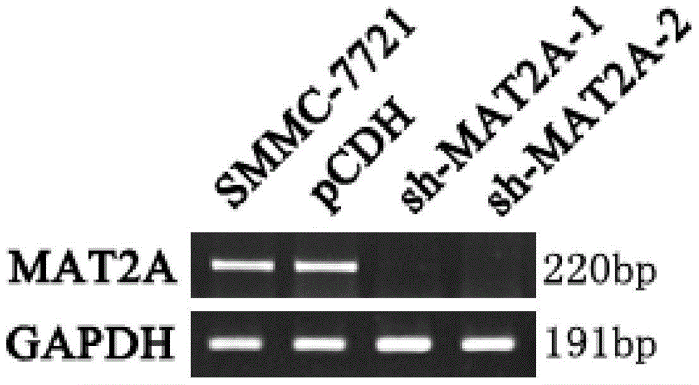 siRNA capable of inhibiting MAT2A genetic expression and application of siRNA