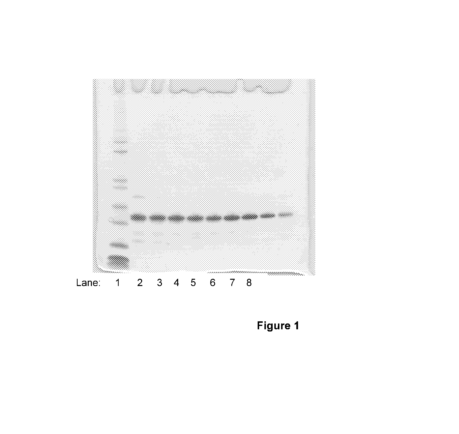 Expression of proteins in E.coli