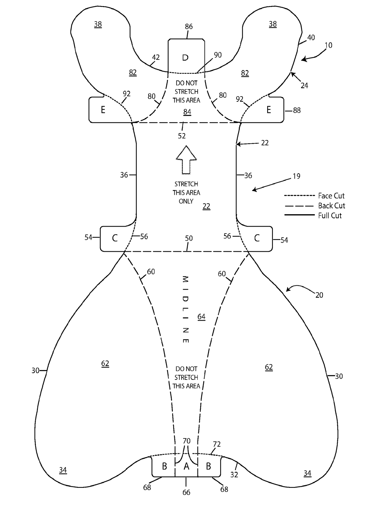 Wound Exposure Device For Use With Patients Having Excessive And/Or Redundant Tissue And Method Of Use