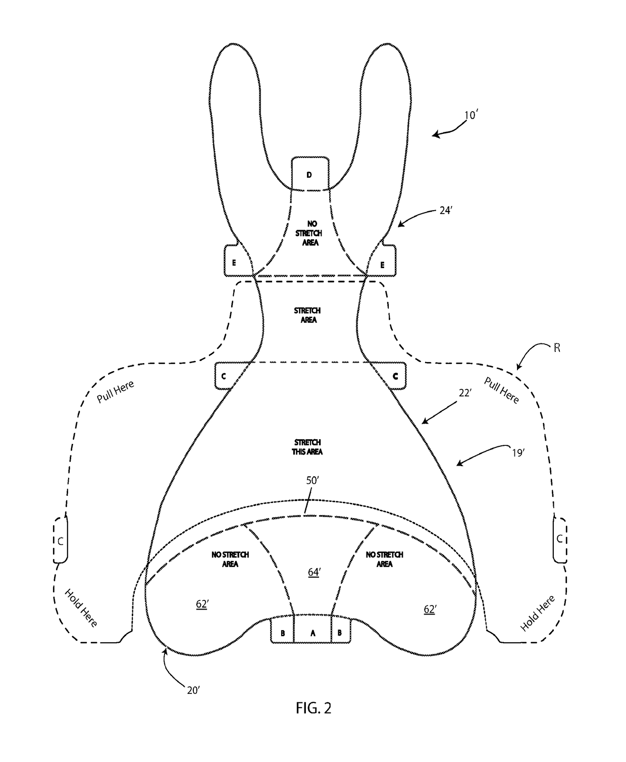 Wound Exposure Device For Use With Patients Having Excessive And/Or Redundant Tissue And Method Of Use