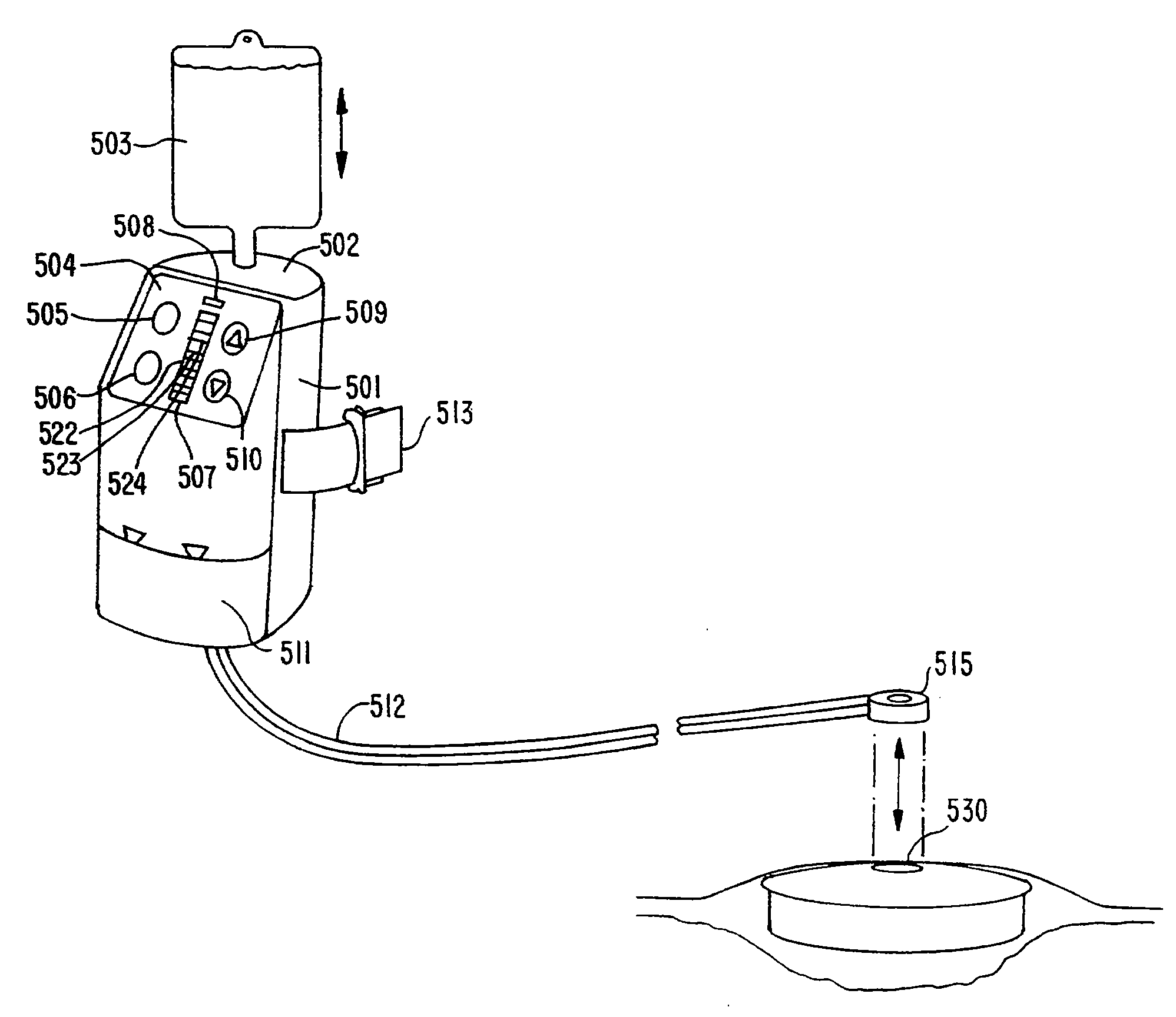 Wound Irrigation Device