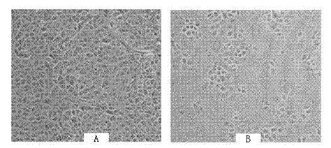 Porcine epidemic diarrhea virus, and culture method and application thereof